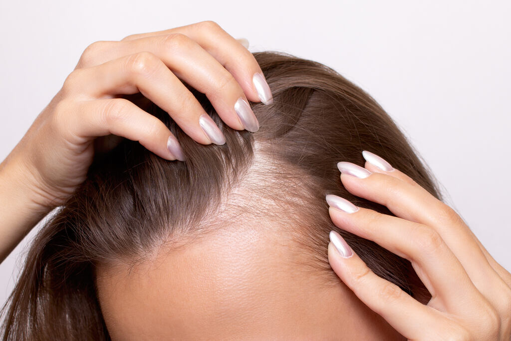 causas queda de cabelo pos partp