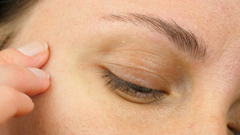 rugas nos olhos